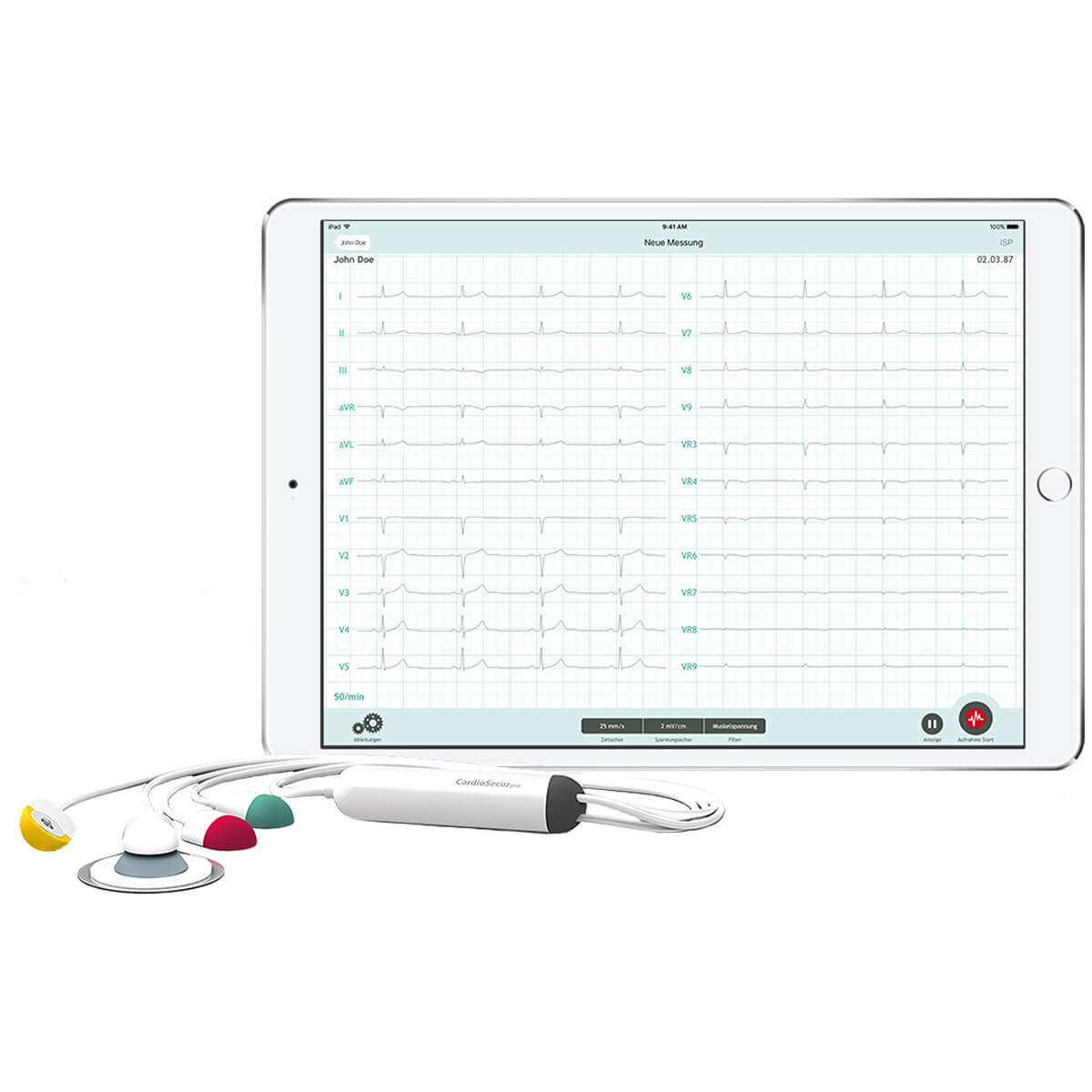 ECG